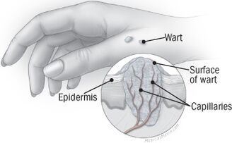 Структурата на брадавицата на ръката